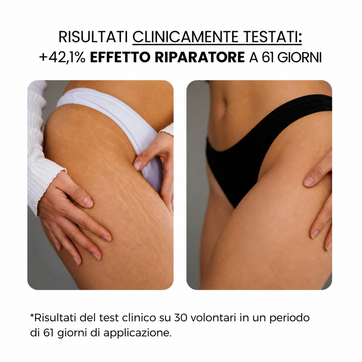 Trattamento antismagliature con derma stamp