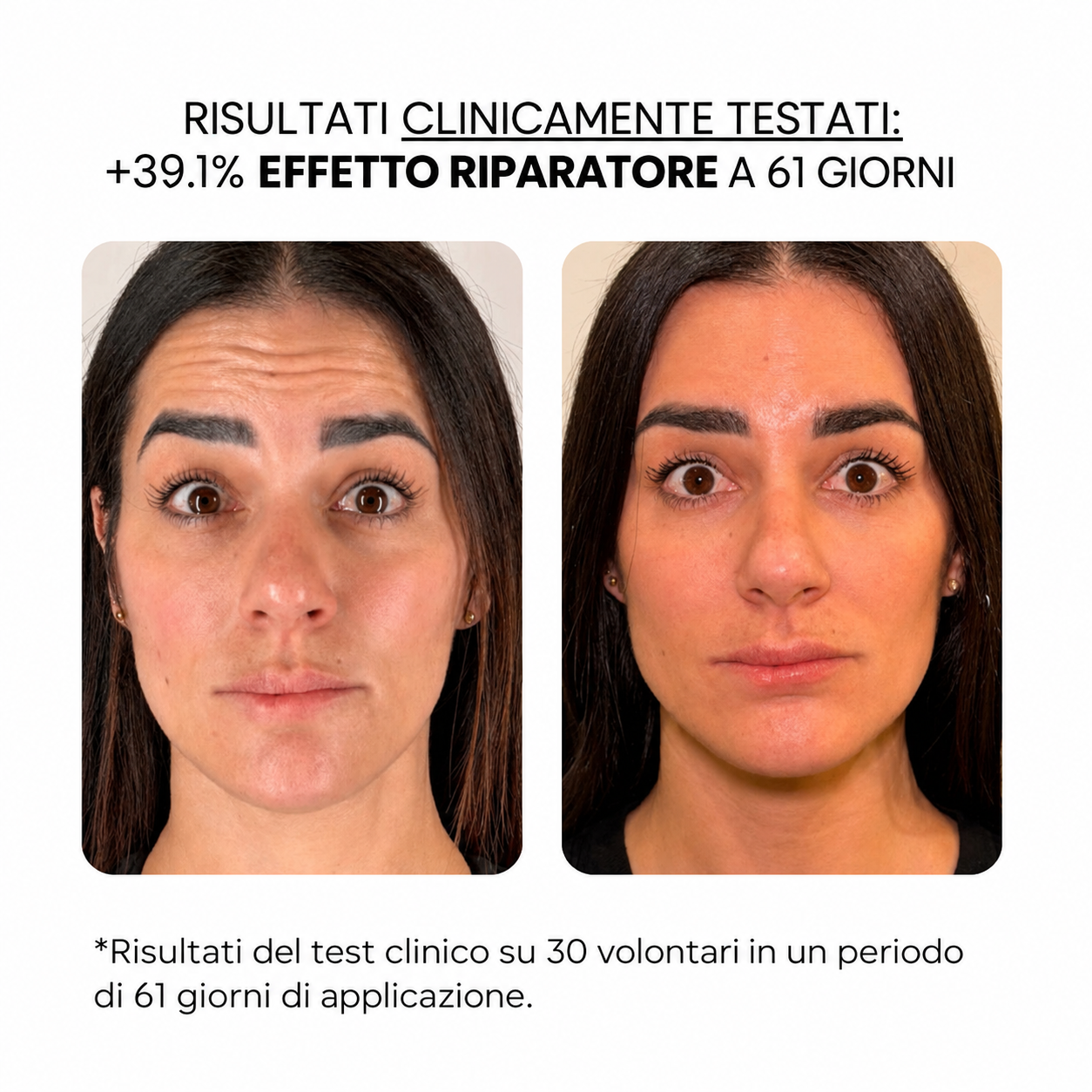 Trattamento antietà con derma stamp