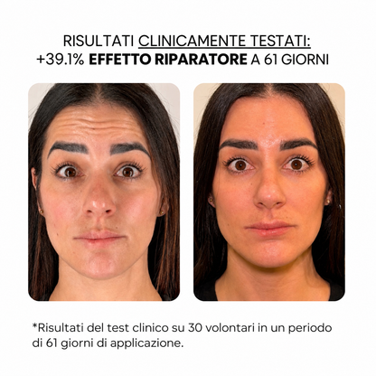 Trattamento antietà con derma stamp
