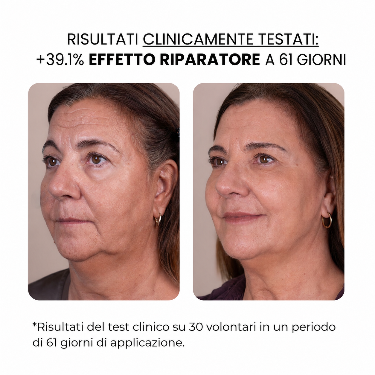 Trattamento antietà con derma stamp