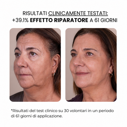 Trattamento antietà con derma stamp