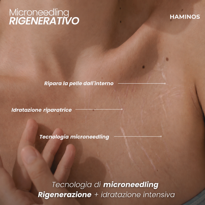 Trattamento antismagliature con derma stamp
