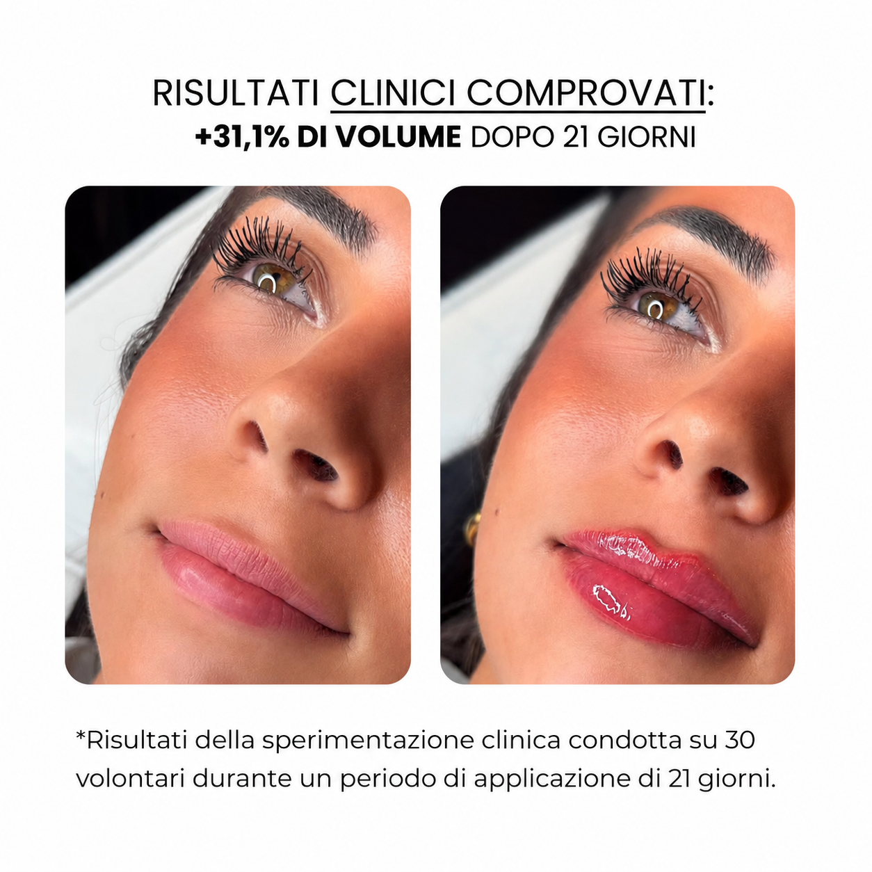 Trattamento per le labbra con derma roller