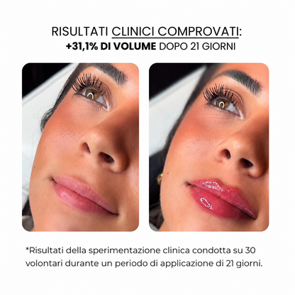 Trattamento per le labbra con derma roller