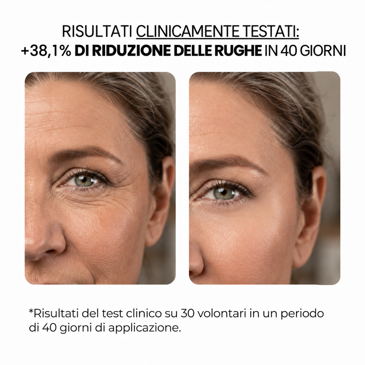 Trattamento antietà con aqua stamp