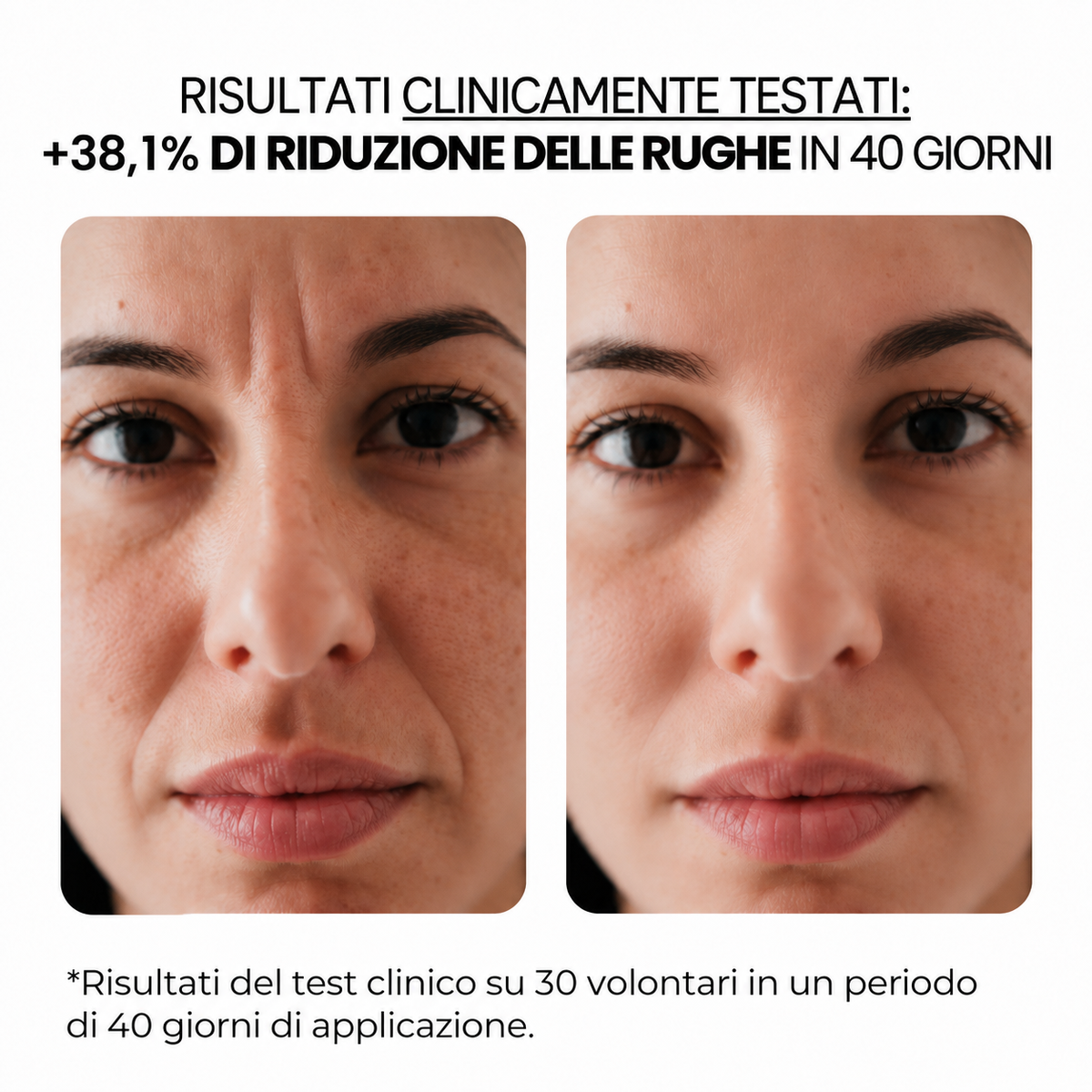 Trattamento antietà con aqua stamp