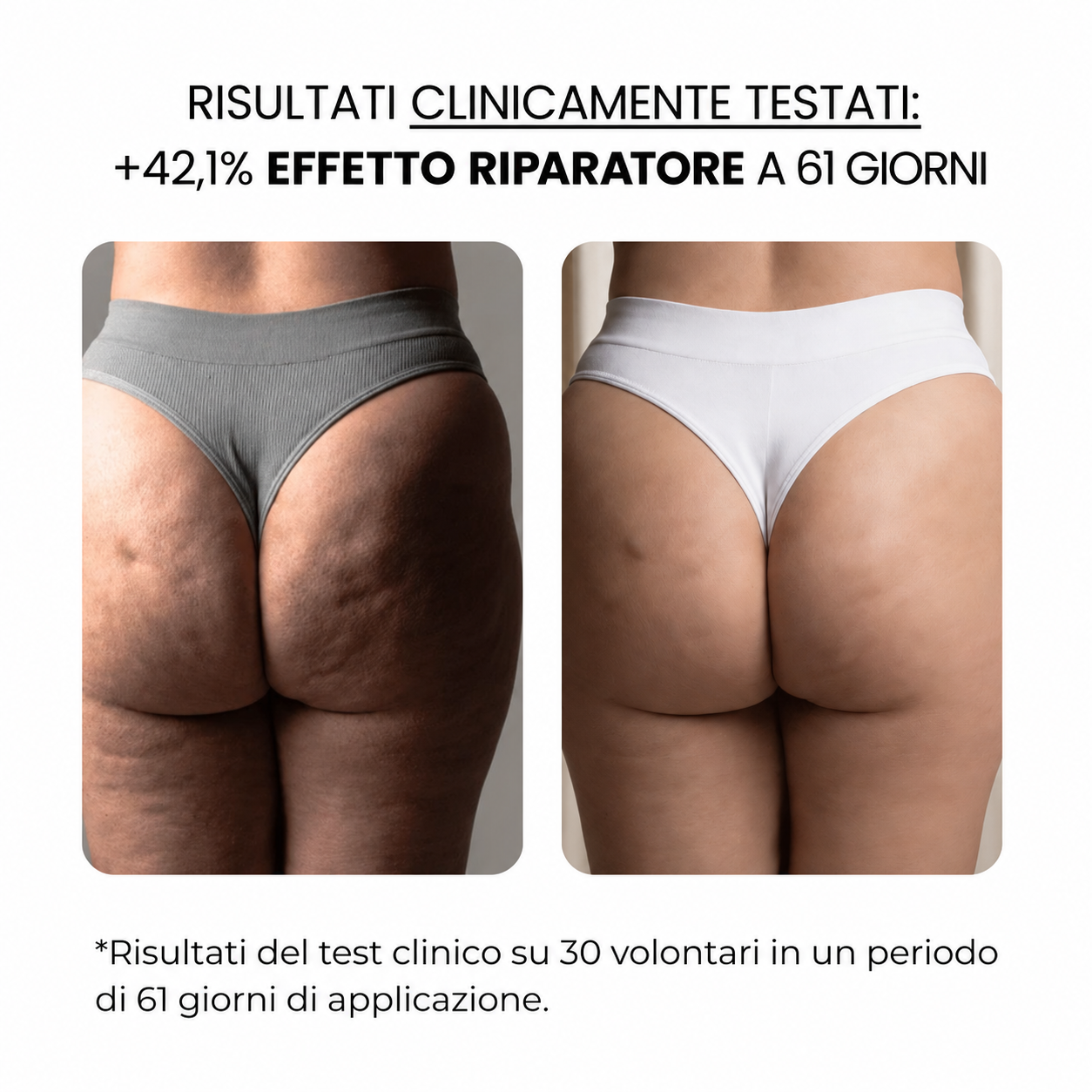 Trattamento antismagliature con derma stamp
