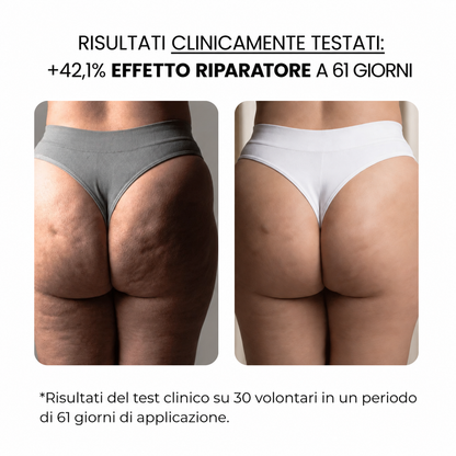 Trattamento antismagliature con derma stamp