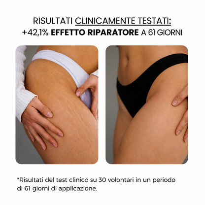Trattamento antismagliature con derma stamp
