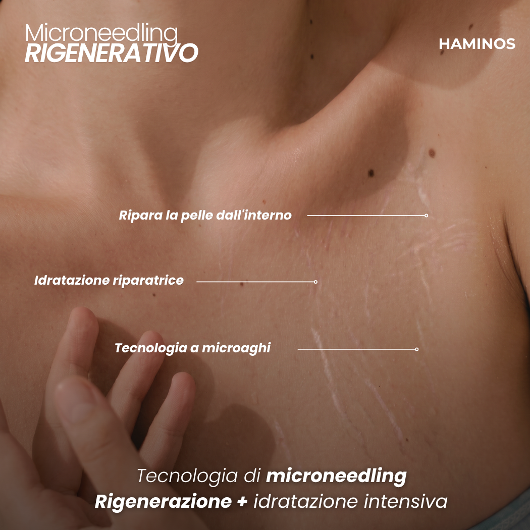 Trattamento Anti Smagliature | HAMINOS®