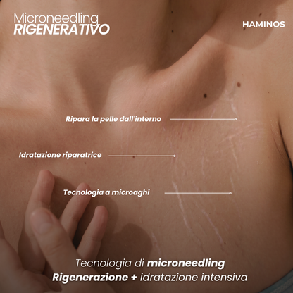 Trattamento Anti Smagliature | HAMINOS®