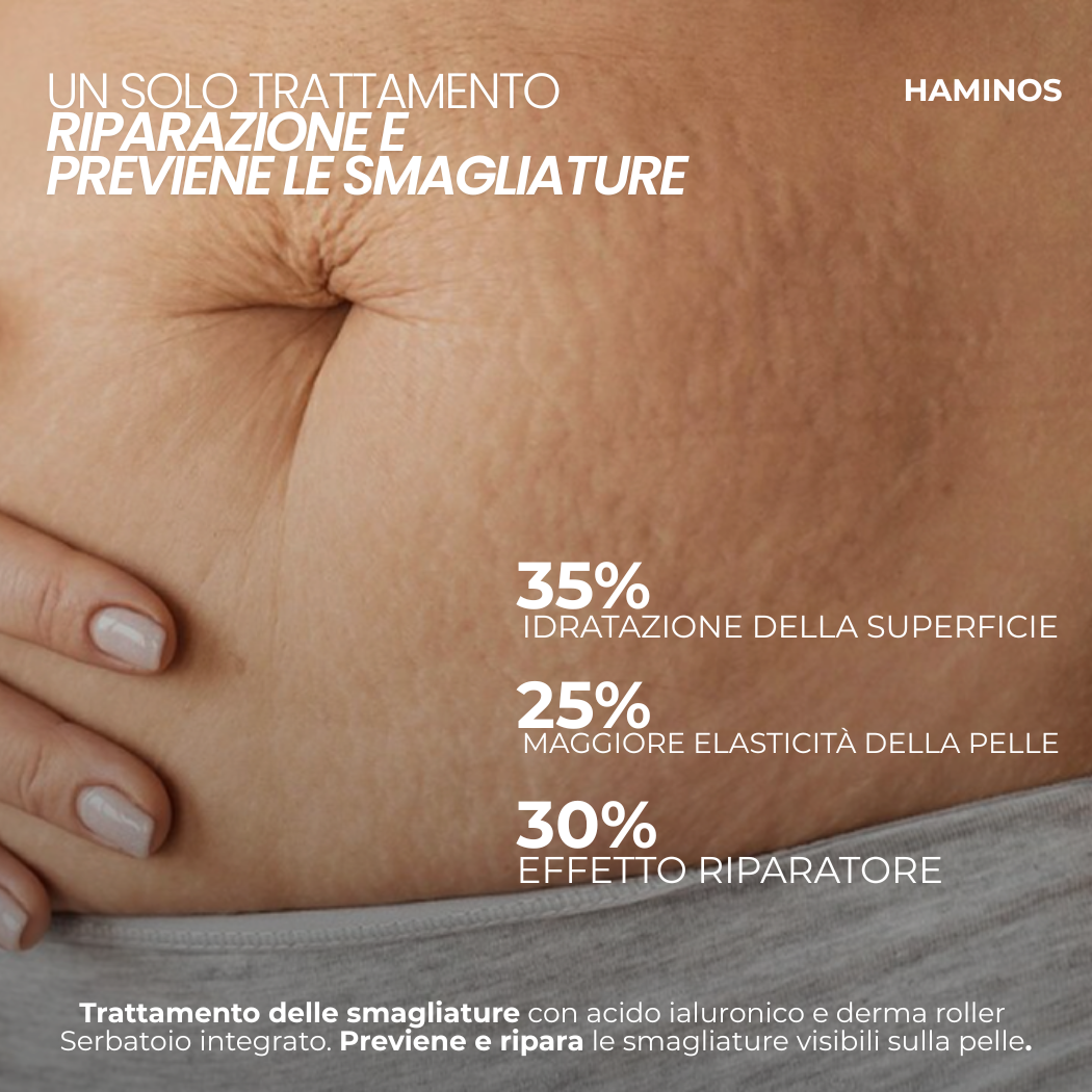 Trattamento Anti Smagliature | HAMINOS®