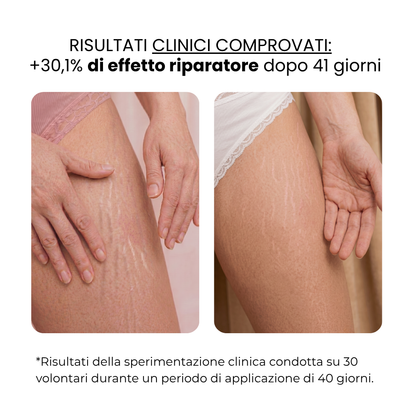 Trattamento Anti Smagliature | HAMINOS®