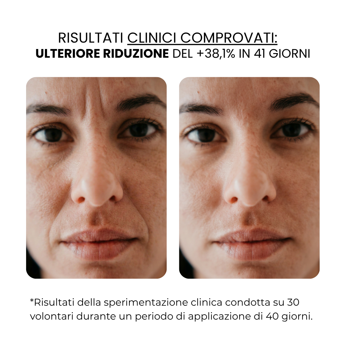 Trattamento Antietà e Nutriente | HAMINOS®