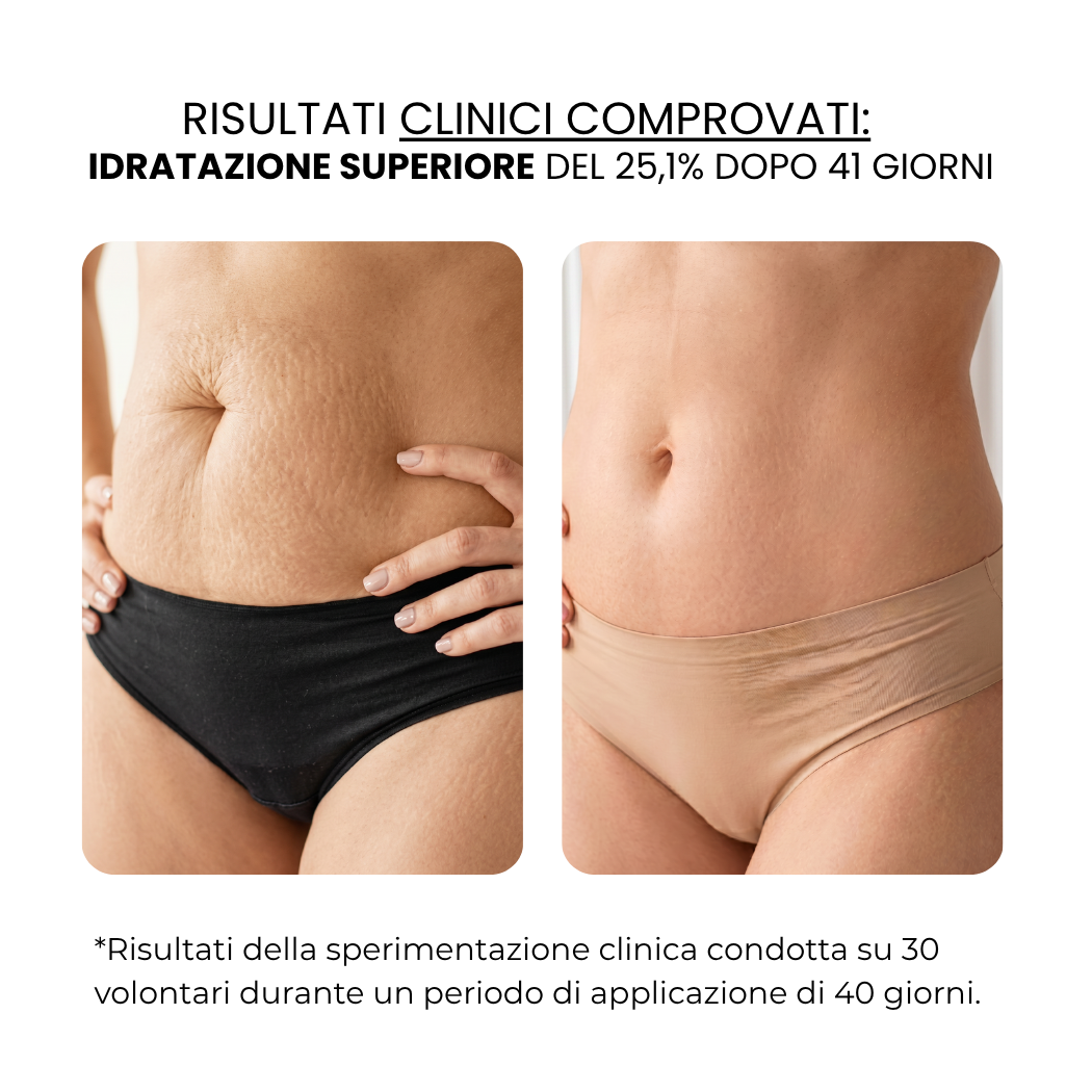 Trattamento Anti Smagliature | HAMINOS®