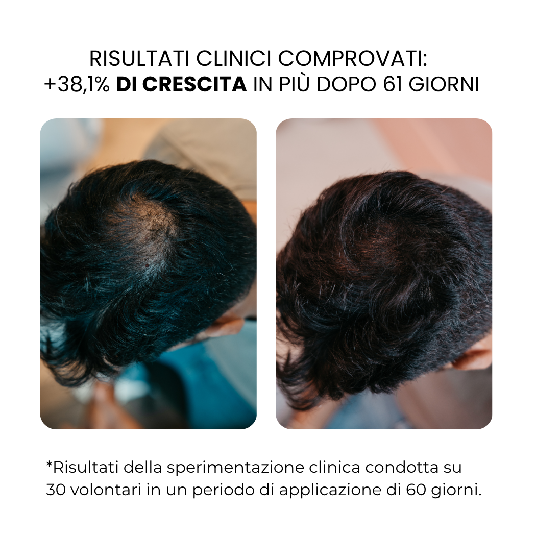 Trattamento per la Crescita dei Capelli e della Barba | HAMINOS®