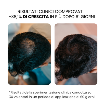 Trattamento per la Crescita dei Capelli e della Barba | HAMINOS®