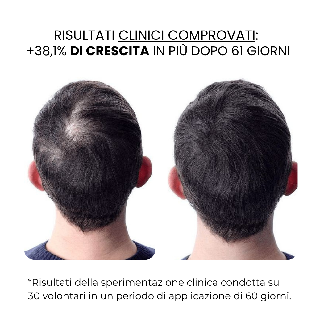 Trattamento per la Crescita dei Capelli e della Barba | HAMINOS®