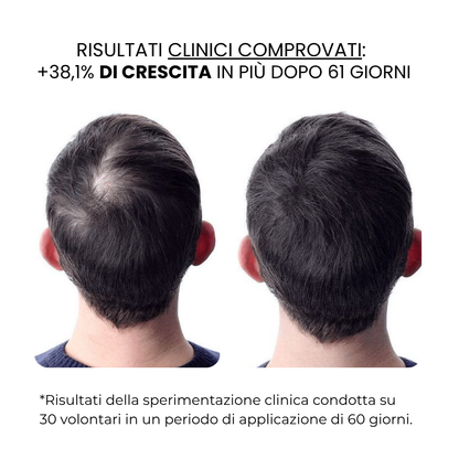 Trattamento per la Crescita dei Capelli e della Barba | HAMINOS®