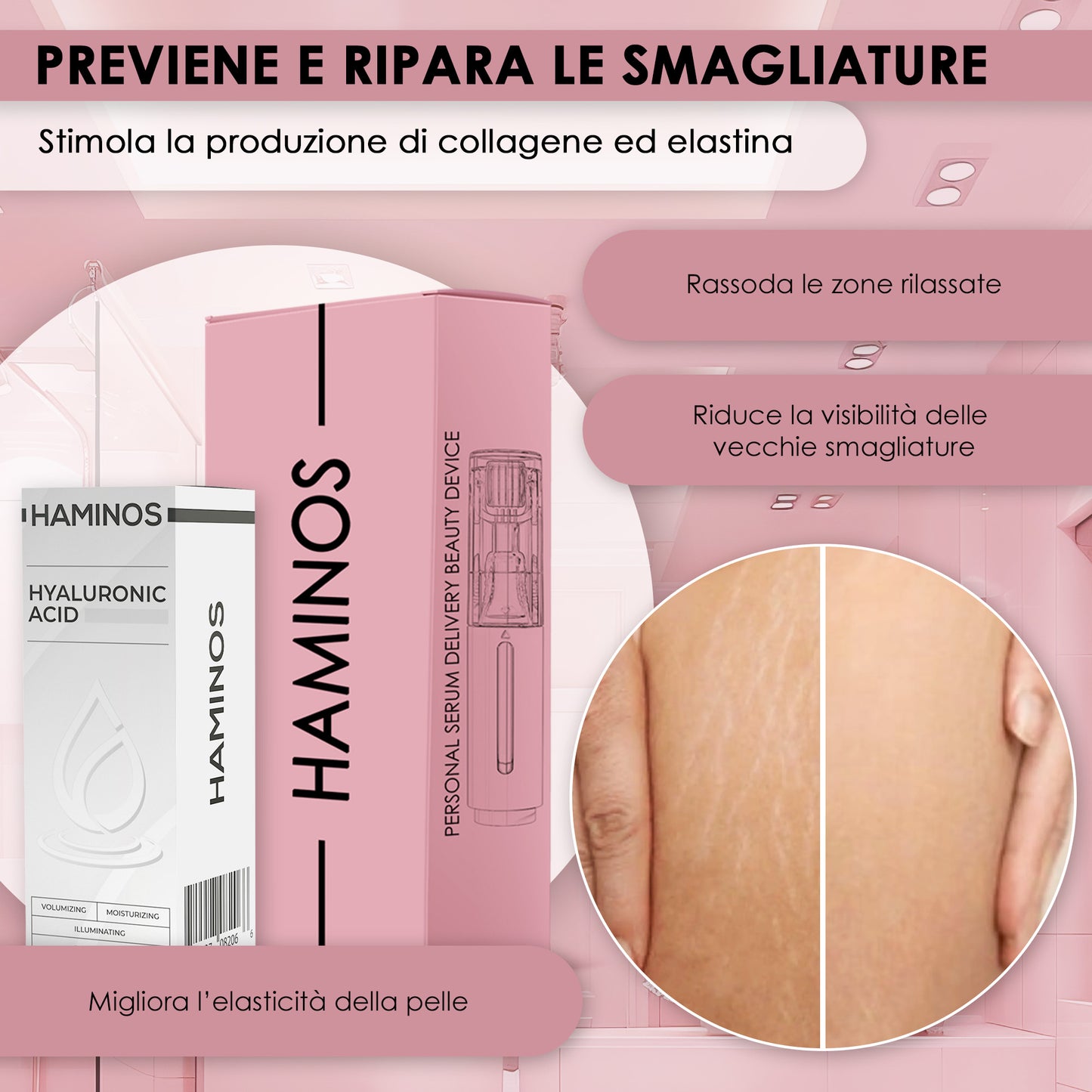 Trattamento Anti Smagliature | HAMINOS®